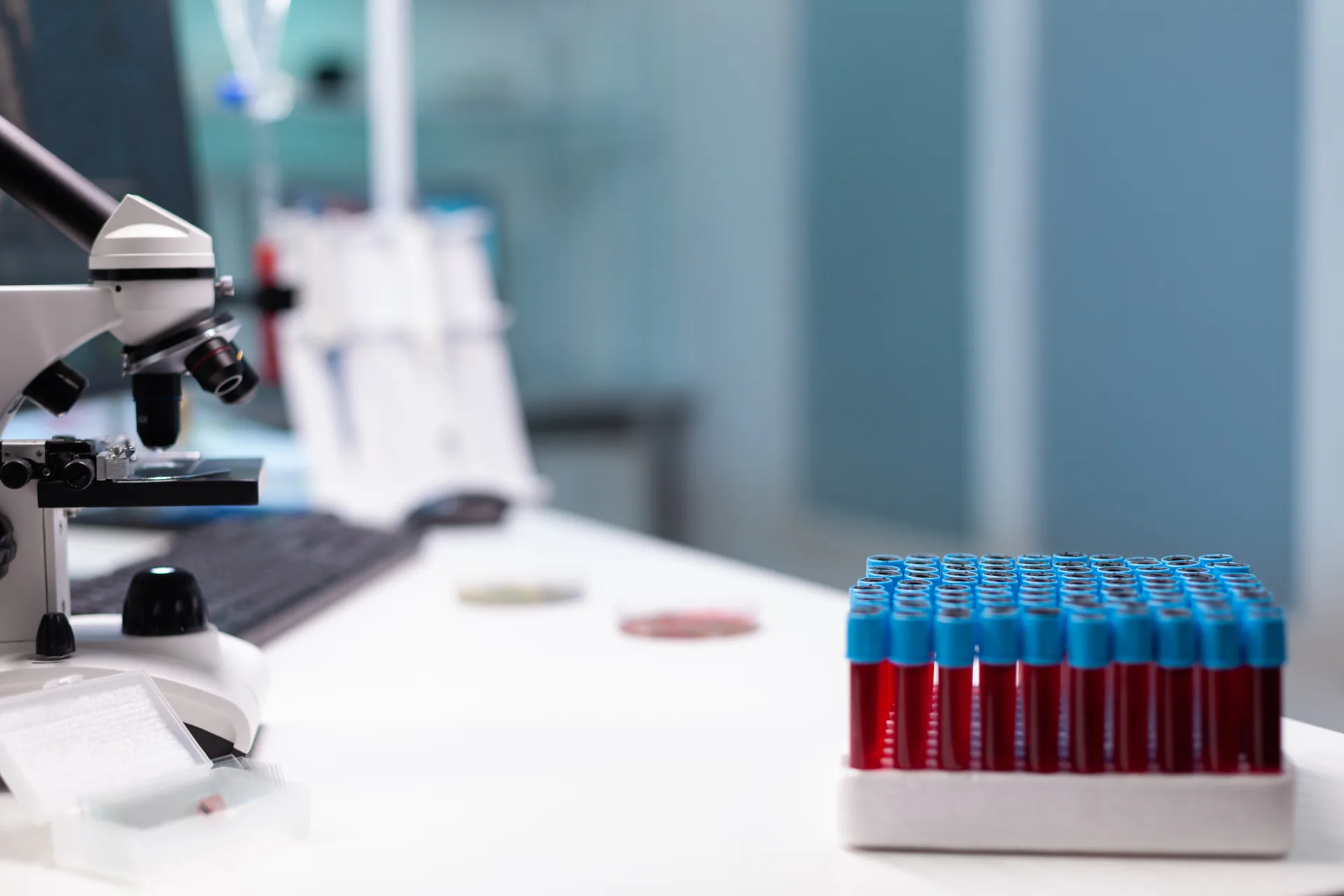 Laboratorio Mattace Raso: case study · Consulenza Marketing, Siti Web Corporate | FV Digital Agency Provette di sangue e microscopio su un bancone di laboratorio di analisi: progetto Laboratorio Mattace Raso di FV Digital Agency
